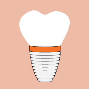 ImplantDentistry